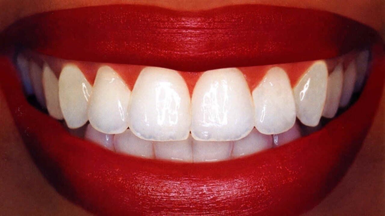 Pratique Comment enlever le tartre sur les dents